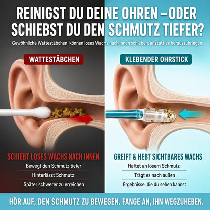 upsell✨ ✨ 1+1 GRATISWiederverwendbarer Ohrreiniger mit Haftspitze – Sanfte Ohrenpflege ohne Kratzen